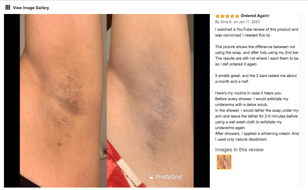 dark underarms before and after picture