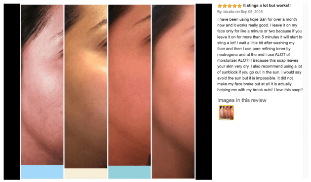 kojie san before and after review