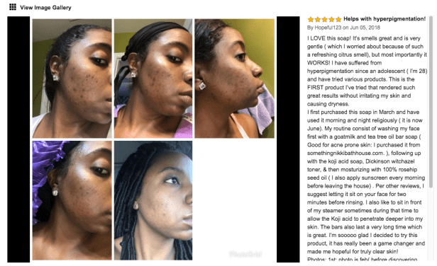 kojic acid soap before and after picture 2